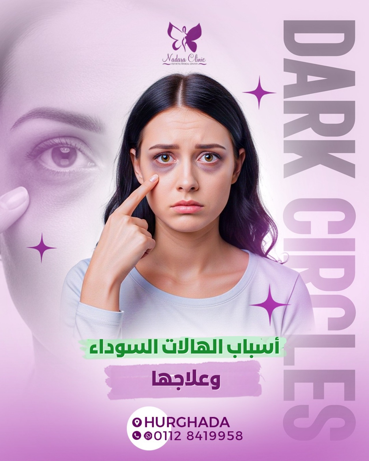 أسباب الهالات السوداء وعلاجها في الغردقة